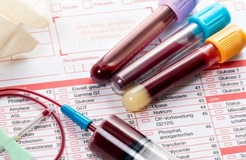 آزمایش خون جدید ۲۰ نوع سرطان را شناسایی می کند